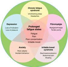 symptoms of fibromyalgia