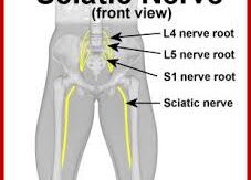 sciatic nerve